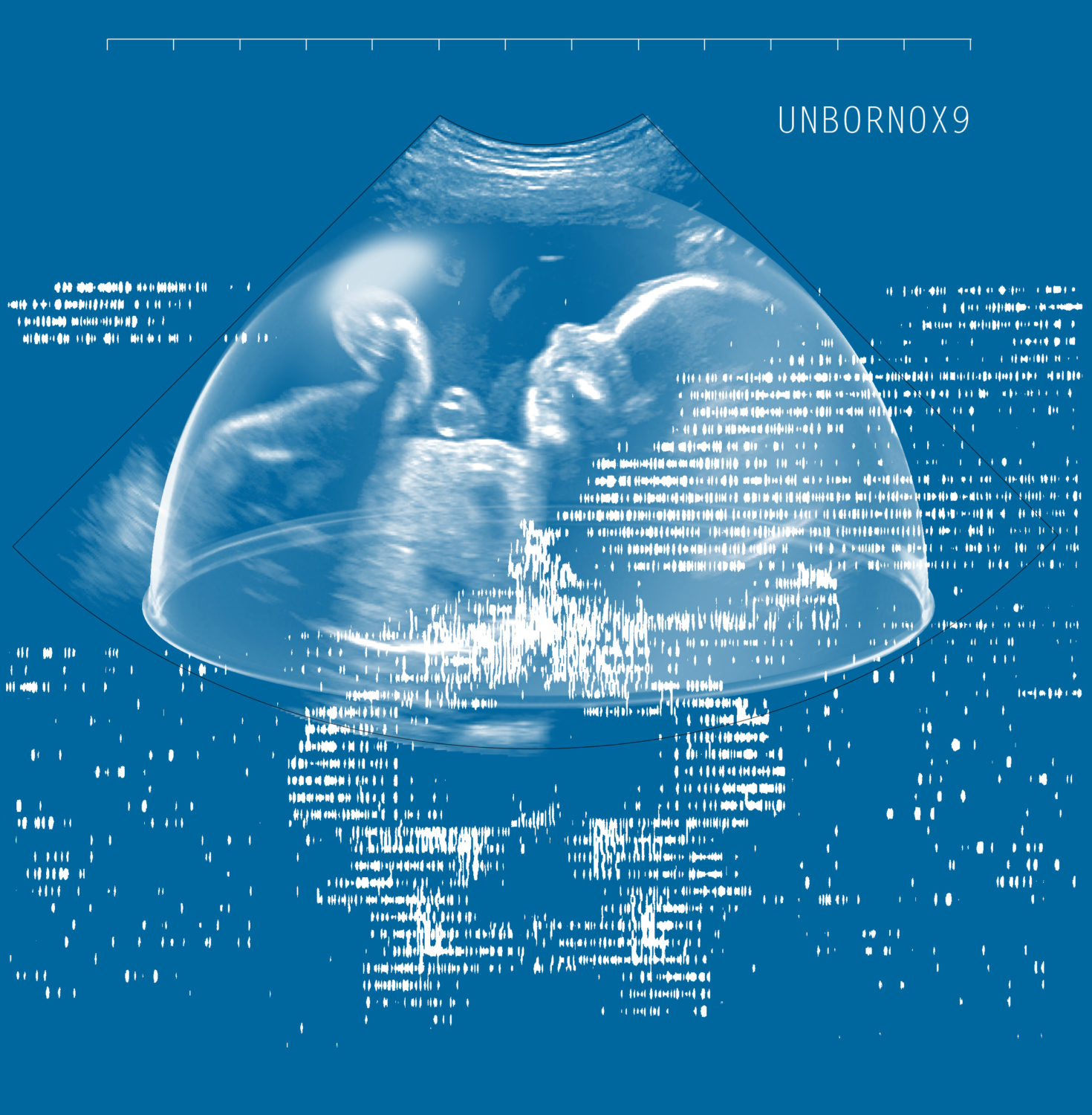 [ REPORTÉ ] Future Baby Production — GMEM Marseille